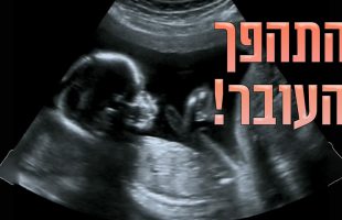 מה אמר הרב לאישה שהתהפך העובר שלה לפני הלידה?