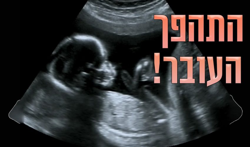 מה אמר הרב לאישה שהתהפך העובר שלה לפני הלידה?